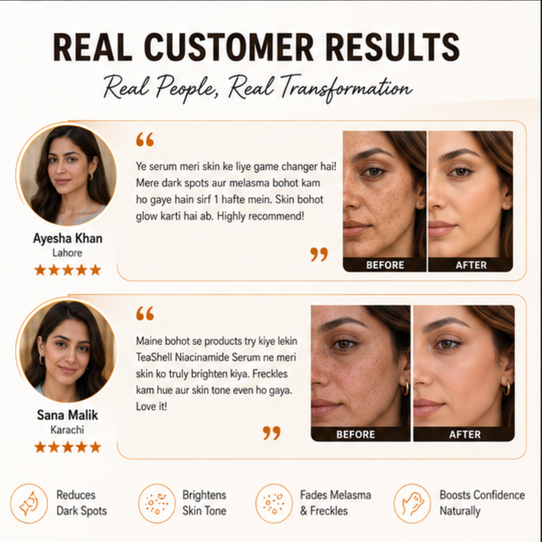 Teashell Niacinamide Brightening Serum – Targets Melasma, Dark Spots & Freckles – Brightens & Evens Skin Tone, Improves Texture & Radiance – For All Skin Types