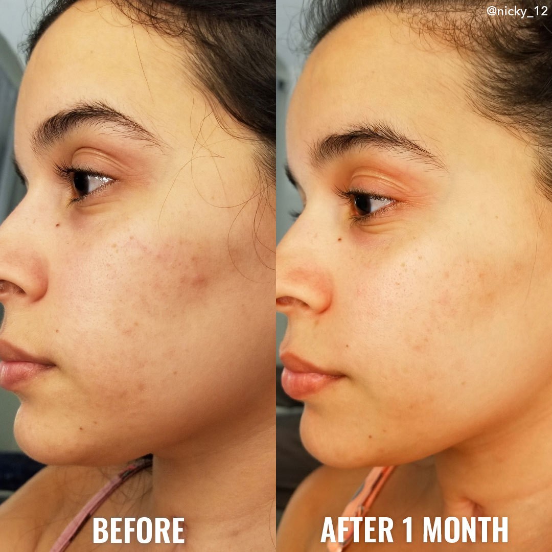 RELUMINS Luminous UltraGlow Toner – 50% OFF – Whitening & Oil Reducing – Brightens Skin Tone, Controls Excess Oil, Refines Pores – Evens Skin Tone, Smooths Texture – Gentle, Refreshing
