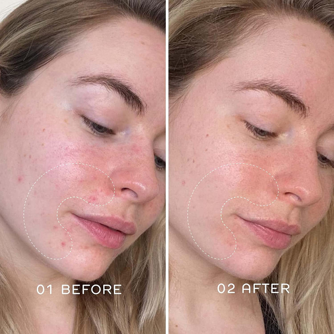 RELUMINS Luminous UltraGlow Toner – 50% OFF – Whitening & Oil Reducing – Brightens Skin Tone, Controls Excess Oil, Refines Pores – Evens Skin Tone, Smooths Texture – Gentle, Refreshing
