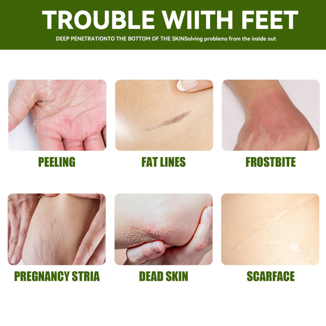 Rozino Tea Tree Oil Foot & Damage Skin Repair Cream | Vitamin E, Aloe Vera & Peppermint | Repairs Cracked Heels, Dry Feet & Rough Skin