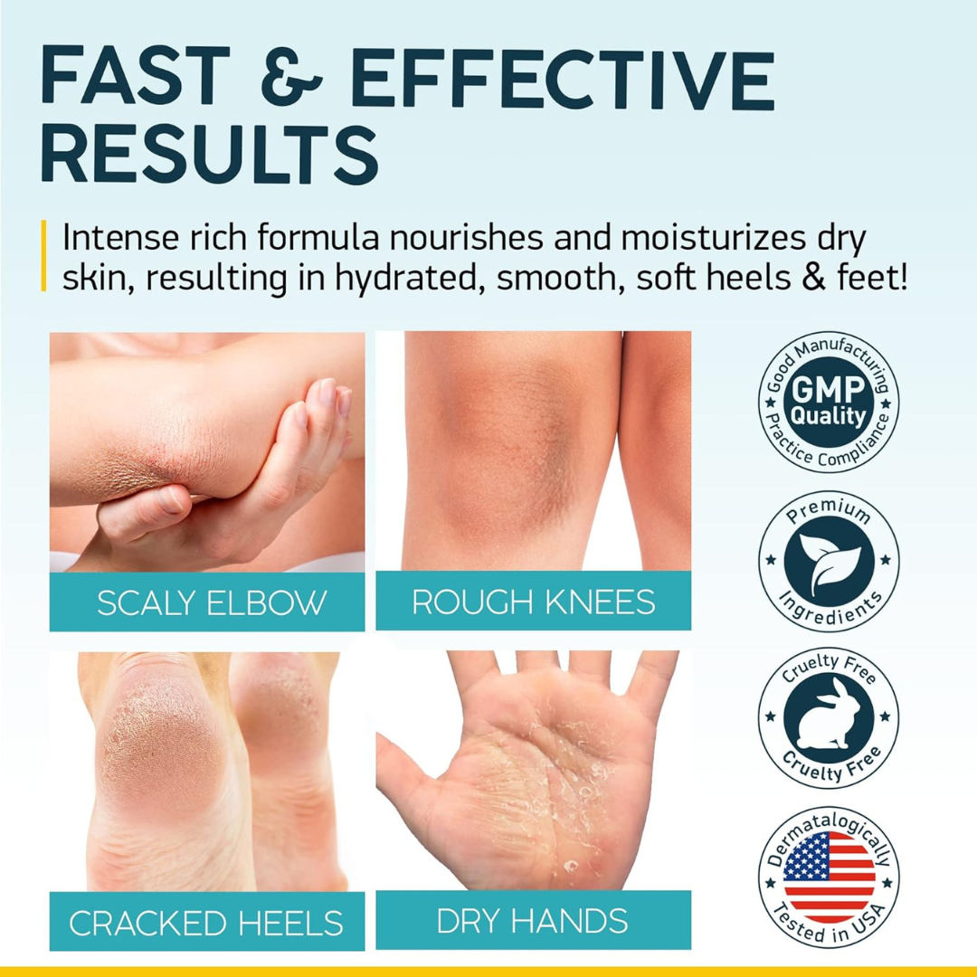 Rozino Tea Tree Oil Foot & Damage Skin Repair Cream | Vitamin E, Aloe Vera & Peppermint | Repairs Cracked Heels, Dry Feet & Rough Skin
