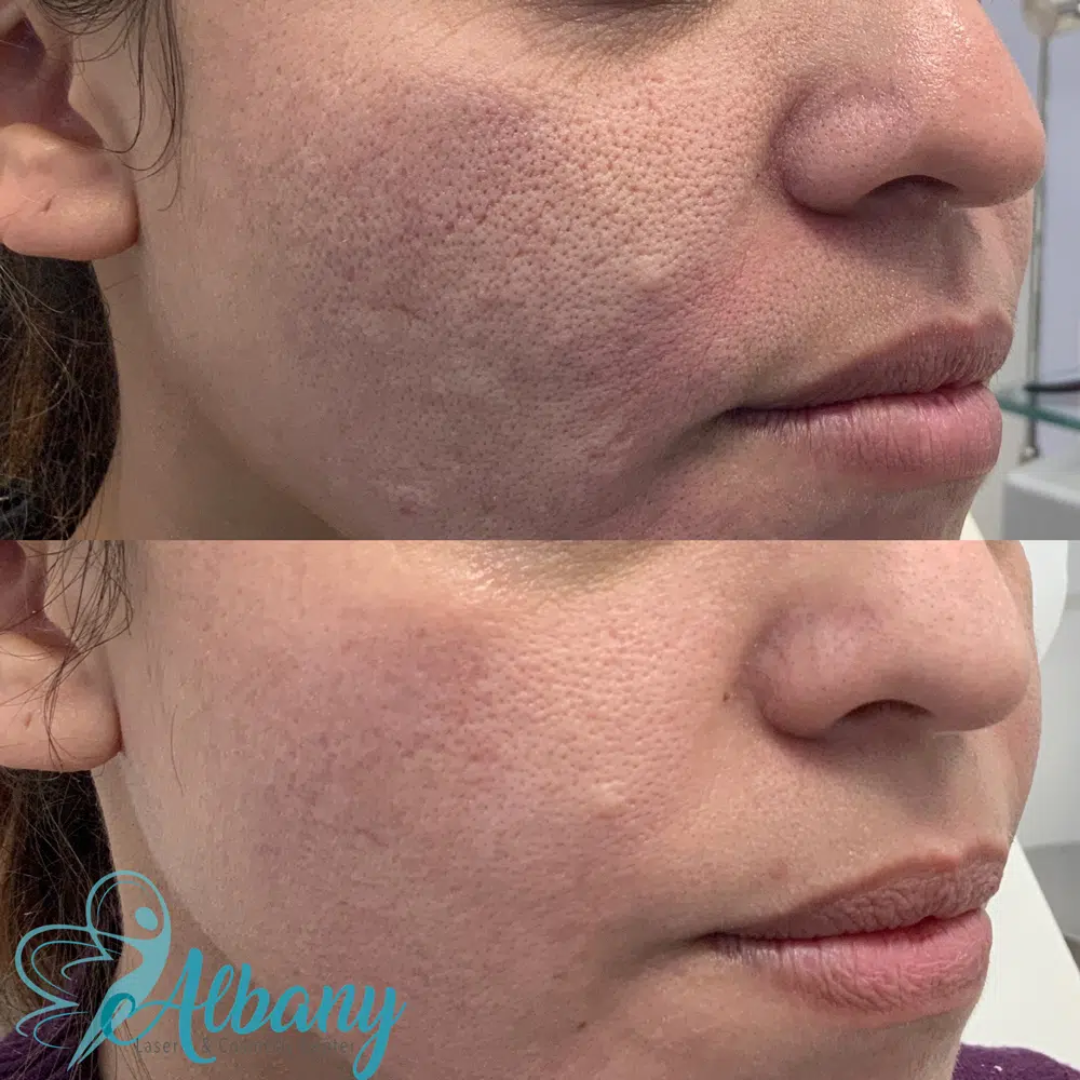 Skin ResQ Brightening Cream | #1 Bestselling Formula with Alpha Arbutin, Niacinamide & Vitamin C | Fades Hyperpigmentation, Dark Spots & Acne Marks