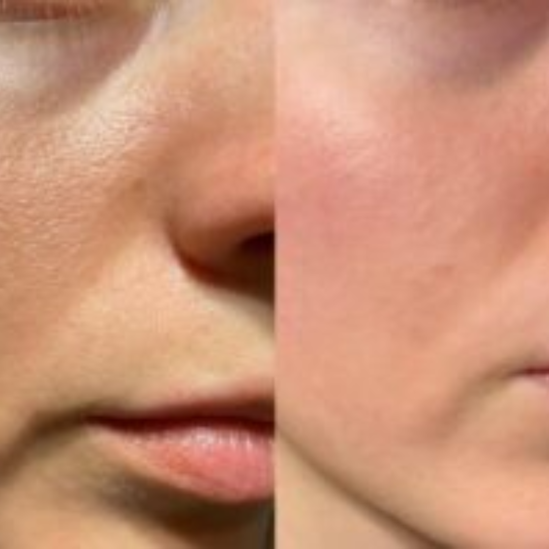 Skin ResQ Brightening Cream | #1 Bestselling Formula with Alpha Arbutin, Niacinamide & Vitamin C | Fades Hyperpigmentation, Dark Spots & Acne Marks