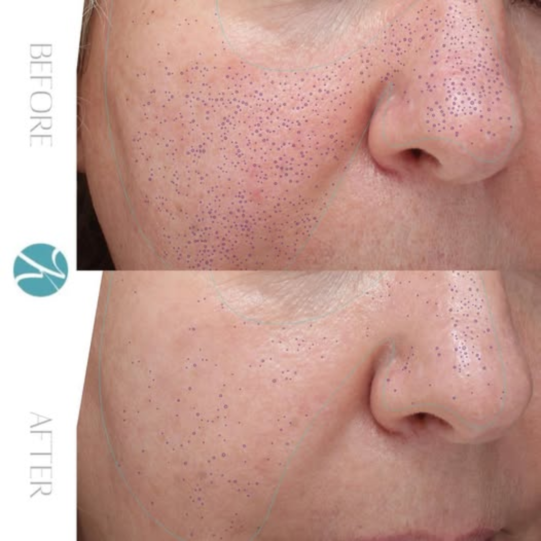 Skin ResQ Brightening Cream | #1 Bestselling Formula with Alpha Arbutin, Niacinamide & Vitamin C | Fades Hyperpigmentation, Dark Spots & Acne Marks