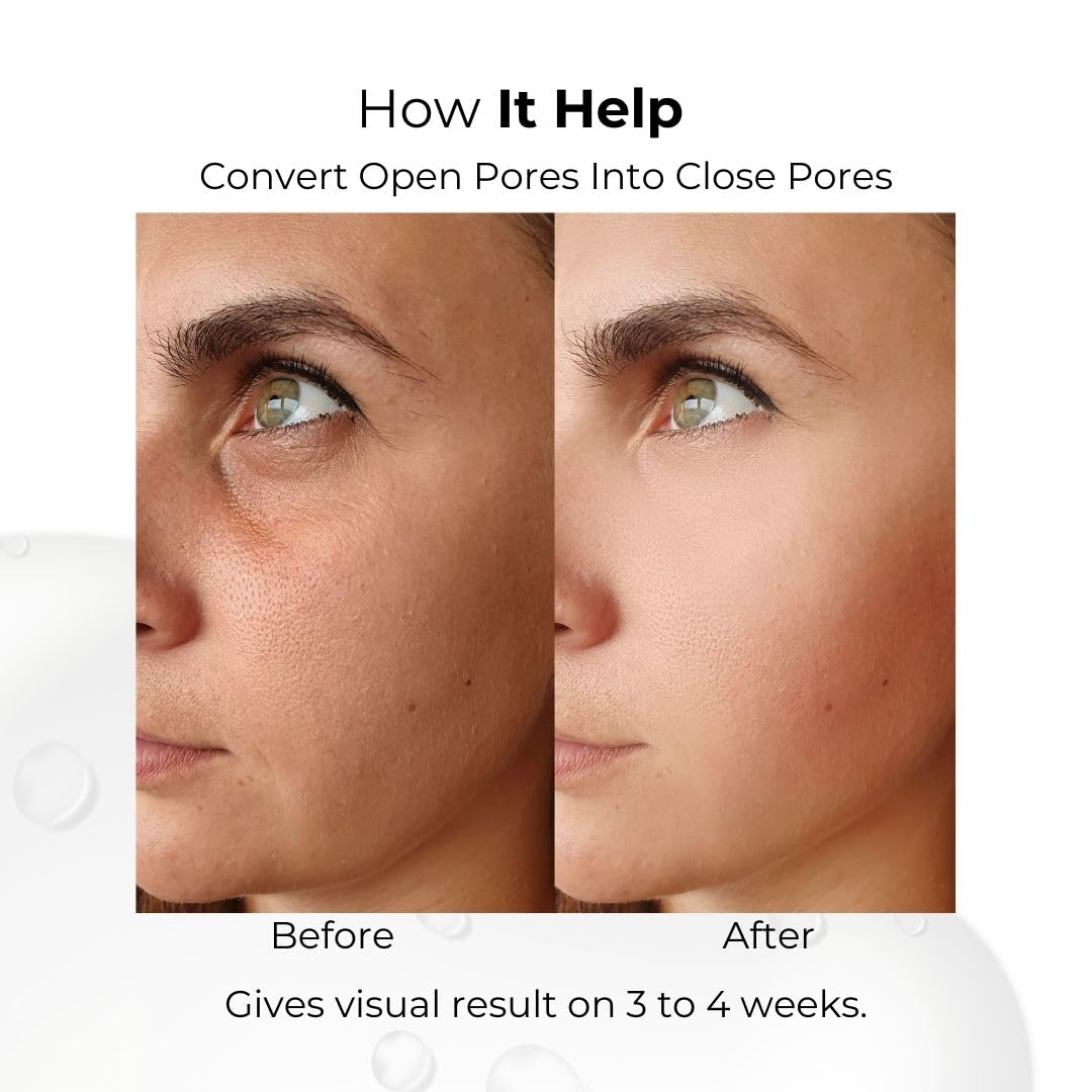 Skin ResQ Brightening Cream | #1 Bestselling Formula with Alpha Arbutin, Niacinamide & Vitamin C | Fades Hyperpigmentation, Dark Spots & Acne Marks