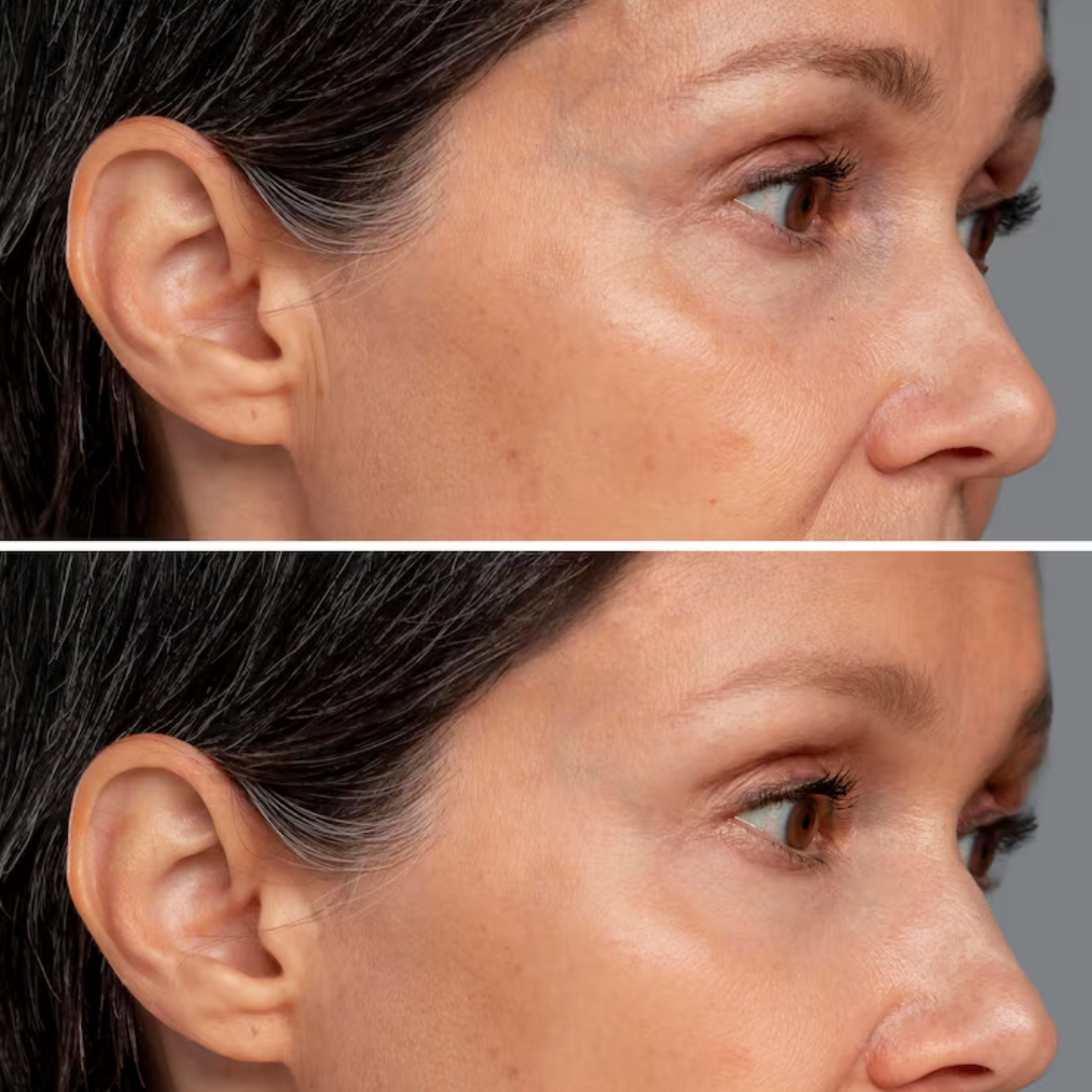 Skin ResQ Brightening Cream | #1 Bestselling Formula with Alpha Arbutin, Niacinamide & Vitamin C | Fades Hyperpigmentation, Dark Spots & Acne Marks