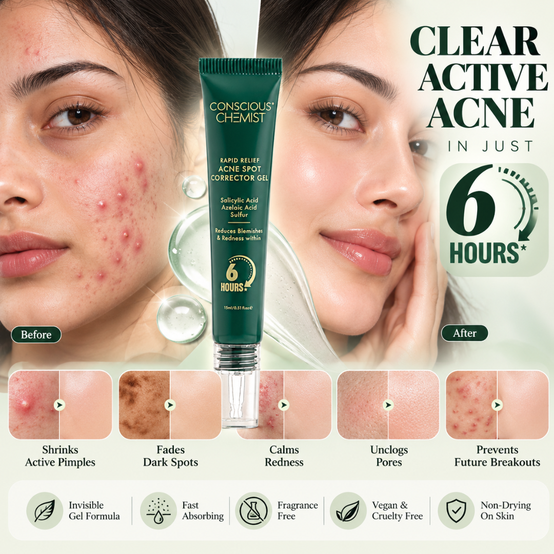 Conscious Chemist Rapid Relief Acne Spot Corrector Gel – Triple-Action Formula with Salicylic Acid & Sulfur, Fades Blemishes & Redness in 6 Hours for Clear Skin