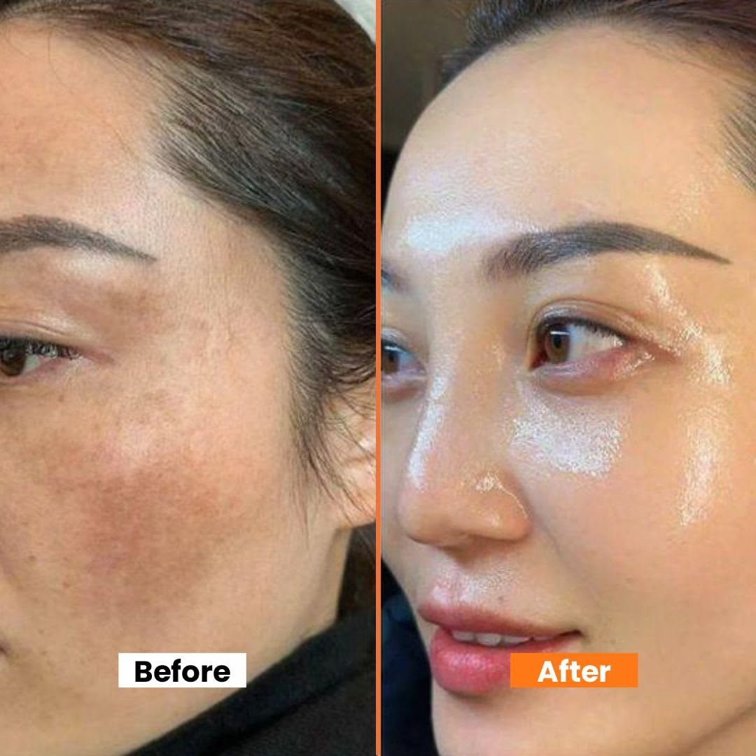 WG Dragon Blood Cream for instant glow & Tone up – Repair, Renew, Rejuvenate & Tone-up – Deep Repair, Intense Hydration, Natural Glow – With Dragon Blood Extract, Retinol & Placenta – Anti-Aging, Firms, Smooths Fine Lines