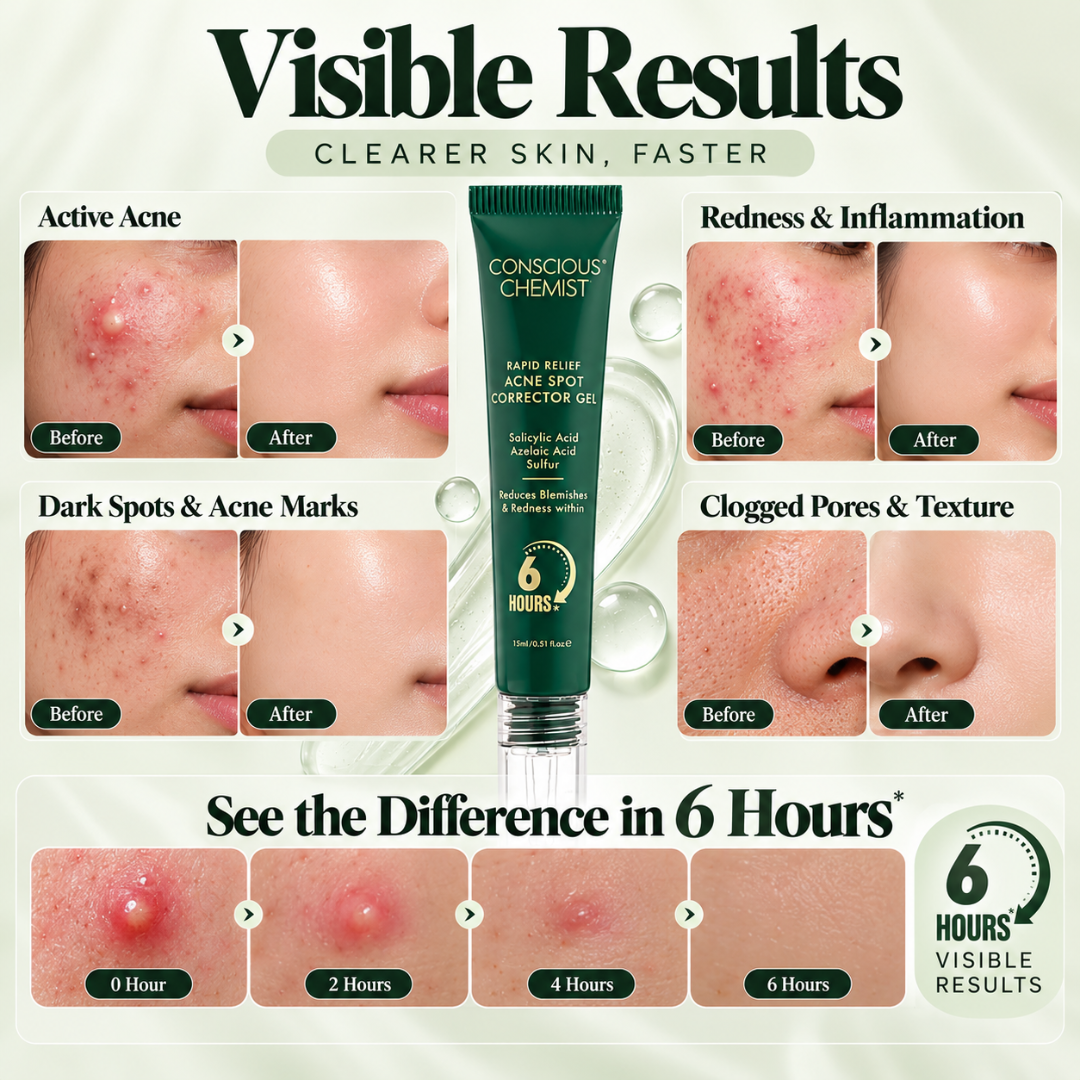 Conscious Chemist Rapid Relief Acne Spot Corrector Gel – Triple-Action Formula with Salicylic Acid & Sulfur, Fades Blemishes & Redness in 6 Hours for Clear Skin