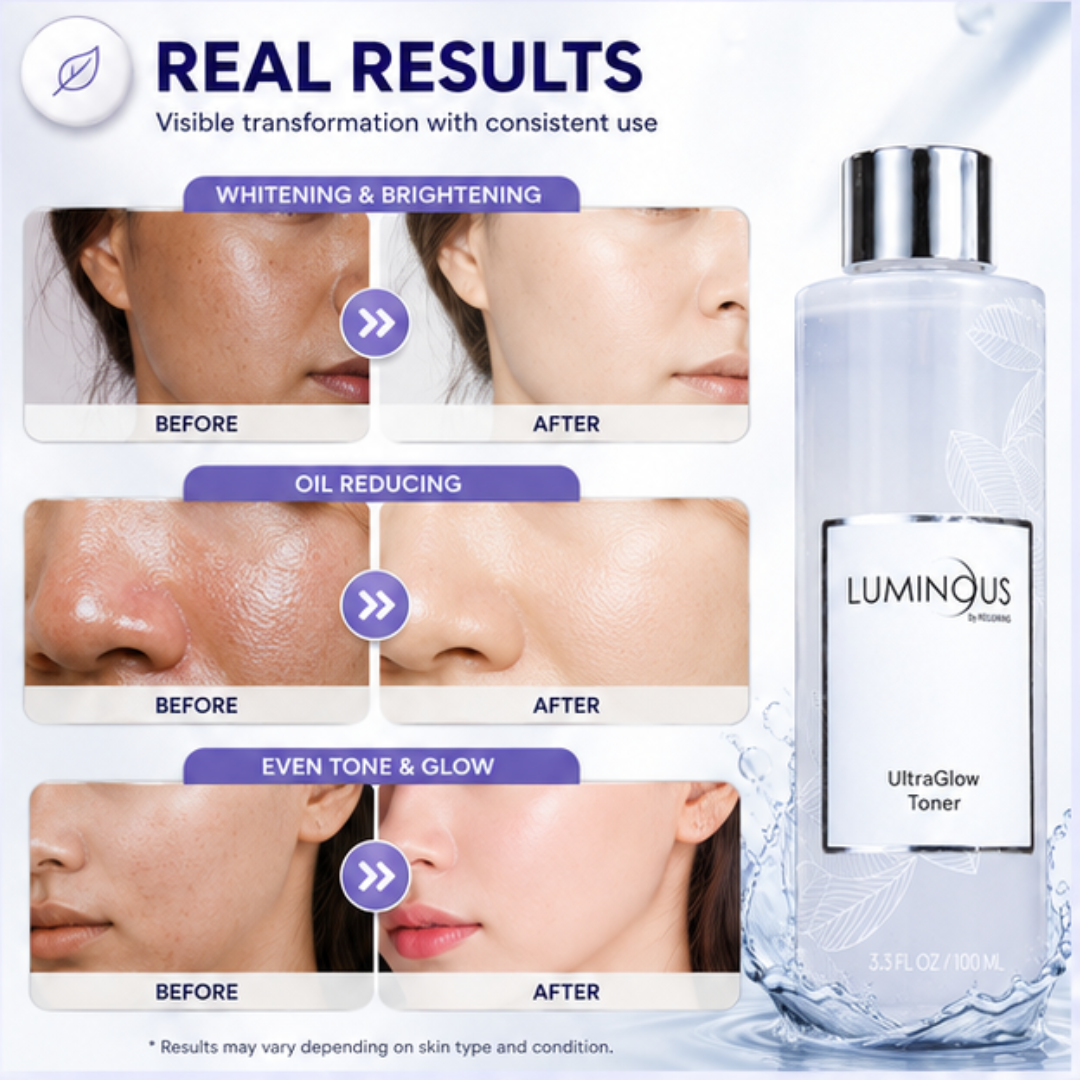 RELUMINS Luminous UltraGlow Toner – 50% OFF – Whitening & Oil Reducing – Brightens Skin Tone, Controls Excess Oil, Refines Pores – Evens Skin Tone, Smooths Texture – Gentle, Refreshing