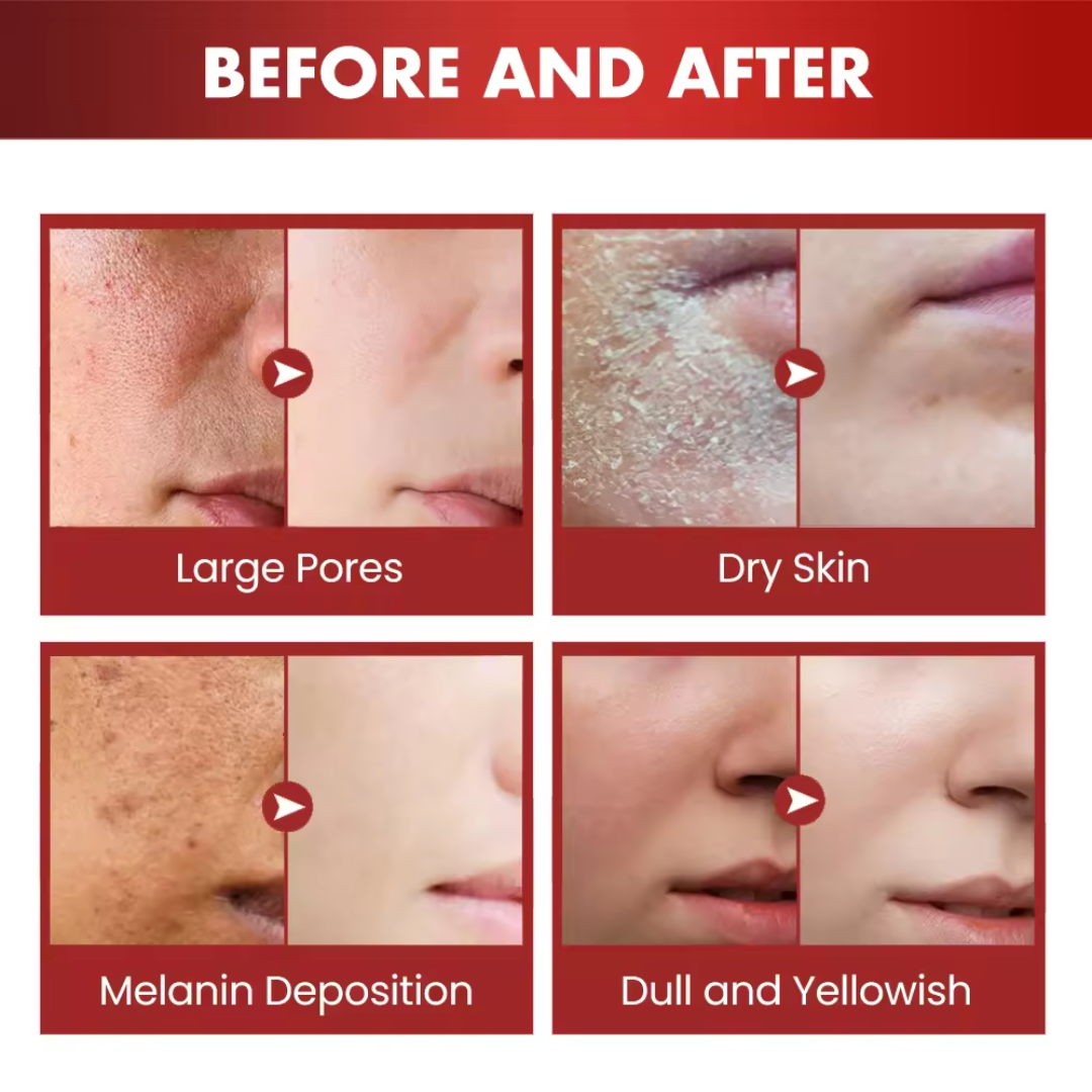 WG Dragon Blood Cream for instant glow & Tone up – Repair, Renew, Rejuvenate & Tone-up – Deep Repair, Intense Hydration, Natural Glow – With Dragon Blood Extract, Retinol & Placenta – Anti-Aging, Firms, Smooths Fine Lines