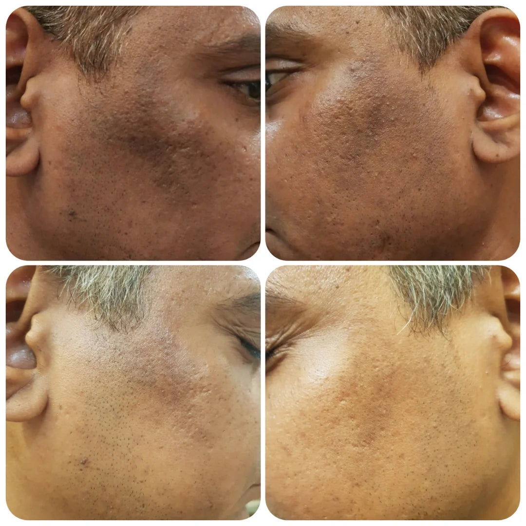 Teashell Niacinamide Brightening Serum – Targets Melasma, Dark Spots & Freckles – Brightens & Evens Skin Tone, Improves Texture & Radiance – For All Skin Types