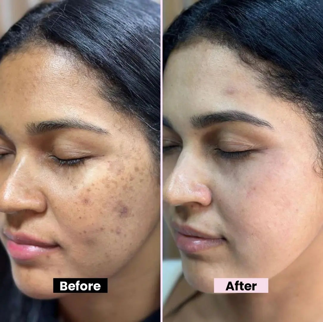 WG Dragon Blood Cream for instant glow & Tone up – Repair, Renew, Rejuvenate & Tone-up – Deep Repair, Intense Hydration, Natural Glow – With Dragon Blood Extract, Retinol & Placenta – Anti-Aging, Firms, Smooths Fine Lines