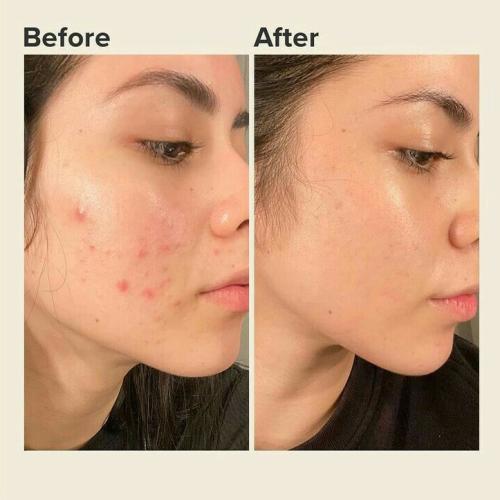 WG Dragon Blood Cream for instant glow & Tone up – Repair, Renew, Rejuvenate & Tone-up – Deep Repair, Intense Hydration, Natural Glow – With Dragon Blood Extract, Retinol & Placenta – Anti-Aging, Firms, Smooths Fine Lines